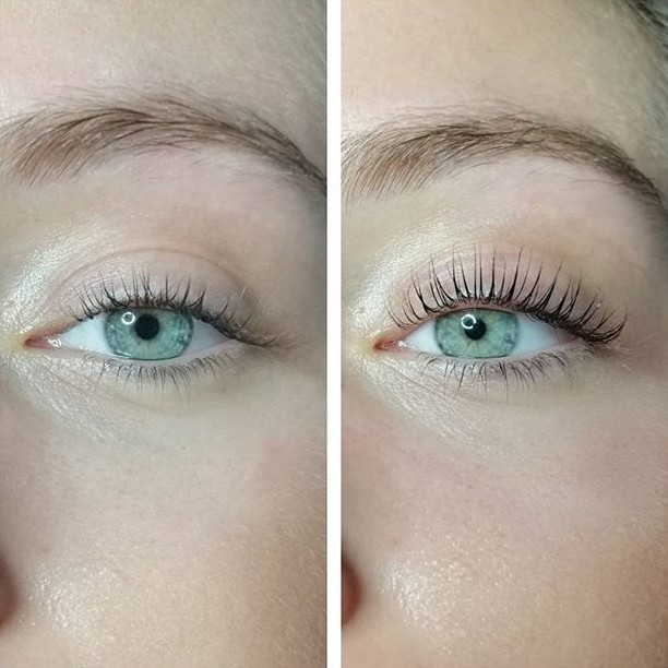 eye-lash-lifting eye-lash-lifting